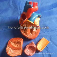 ISO New Style Adult Heart Model